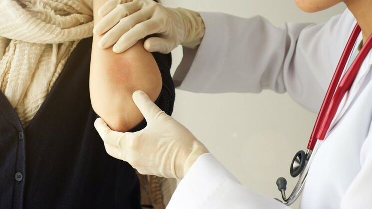 a doctor examines the elbow for psoriasis