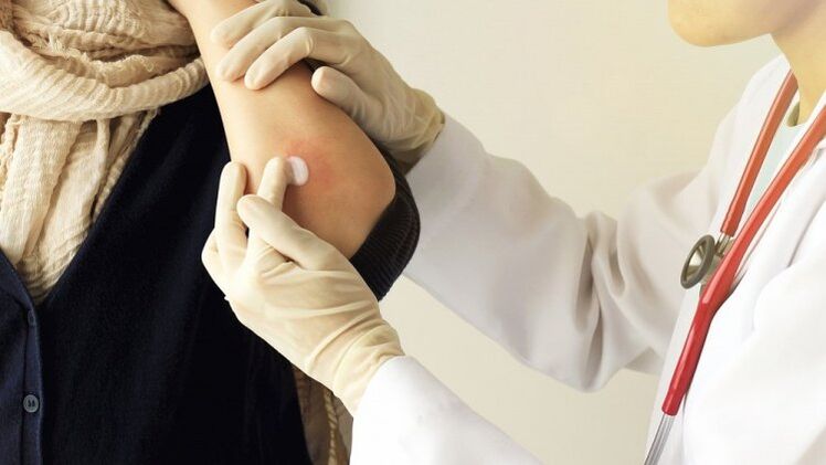 the doctor rubs his elbow for psoriasis
