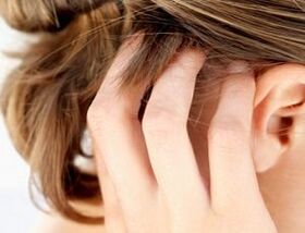 signs and symptoms of scalp psoriasis